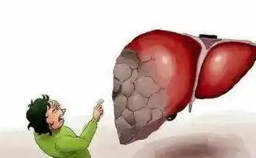 蜂王浆对肝硬化的作用:蜂王浆会加重肝硬化吗?_肝脏__