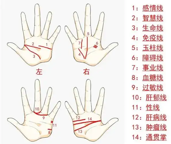 有"断掌纹"的一定要注意,不仅影响情绪,还会影响寿命