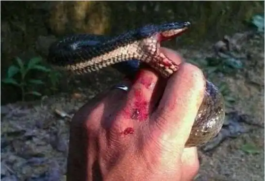 和有毒蛇咬伤伤口对比图无毒蛇咬伤伤口对比无毒蛇咬伤伤口绘制图作者