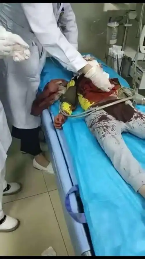 重庆巴南幼儿园伤人事件:精神病妇女从"一个通道"进入?