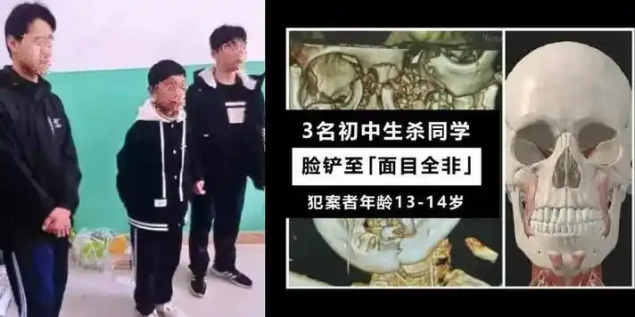 看到邯郸初中生杀人犯的表情我想起了一位同学