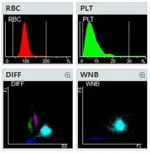 种豆得瓜,一例血小板卫星现象发现之旅并纠正法宝