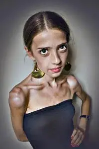 厌食症的少女图片