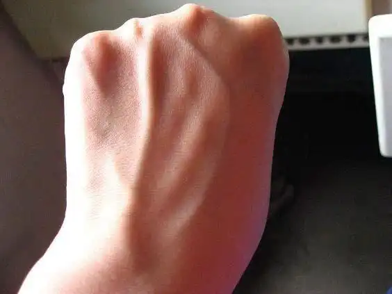 血管|手背|血液_网易订阅