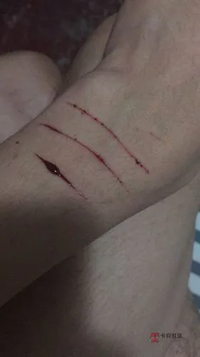 欠了20多万 每天都生不如s割自己几刀才舒服…为什么要赌博.