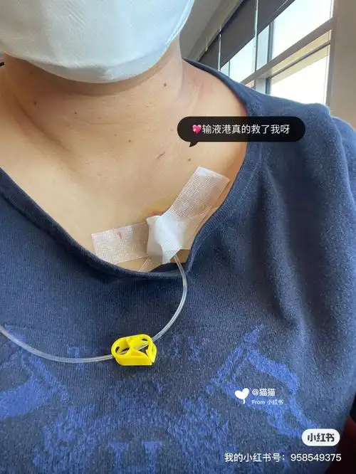 乳腺癌 完成第五次化疗