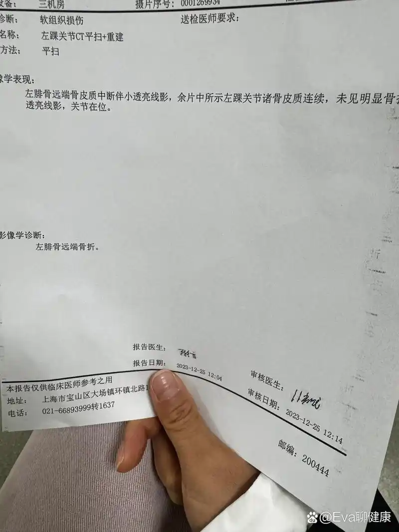 也不知道ct片子在哪里拿  br>我以为只是简单的崴到脚了.