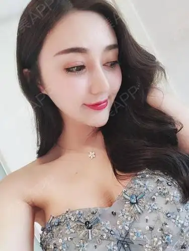 假体隆胸术后36天_隆胸术后36天_胸部整形术后36天_janice珍妮丝分享