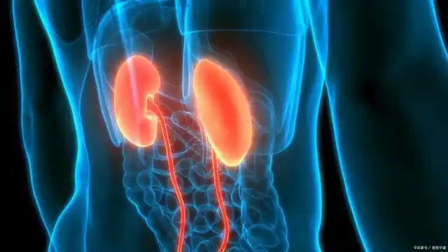 肾结石有哪几种常见病因,早期症状表现是什么?