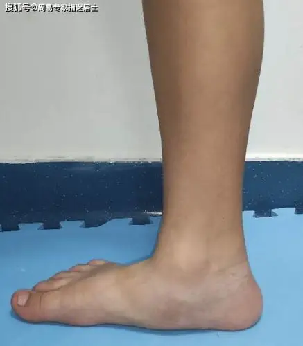 脚相算命扁平足的人事业运势好吗