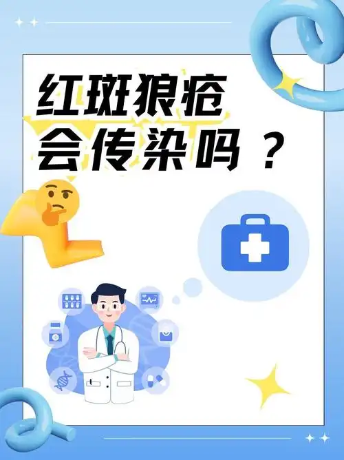 红斑狼疮,会传染吗?04