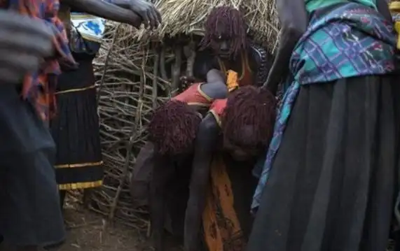男女割礼在非洲等地盛行,是千百年流传的残忍习俗.