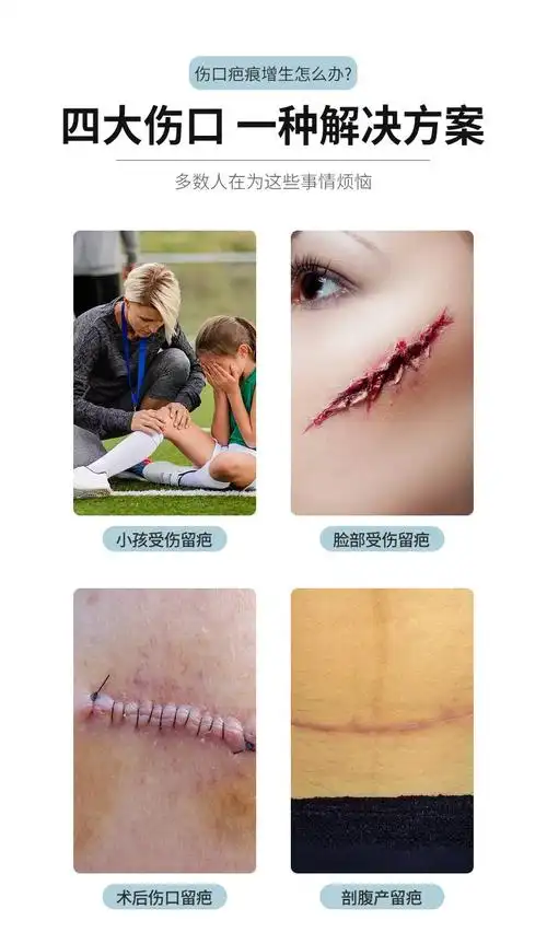 3m皮肤伤口胶带伤口免缝胶布剖腹产疤痕伤口术后伤口减张贴美容胶带