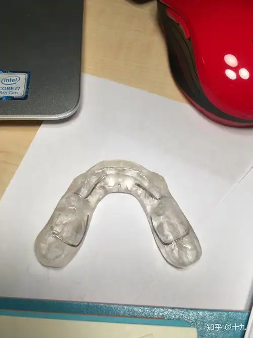 2021515双侧已改善为可复性前移颞下颌关节紊乱正畸不选择手术rw咬合