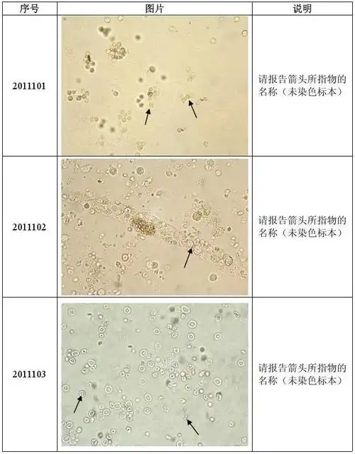 2011新疆临检中心尿沉渣形态学第一次室间质评