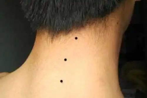 脖子后面有痣代表什么?做事有靠山和贵人为人富贵