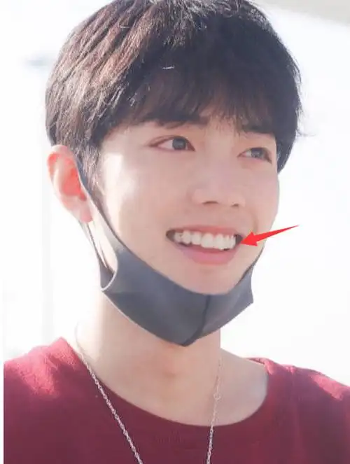 戴牙套是双刃剑毛不易拯救一口烂牙刘雯肖战却变难看了