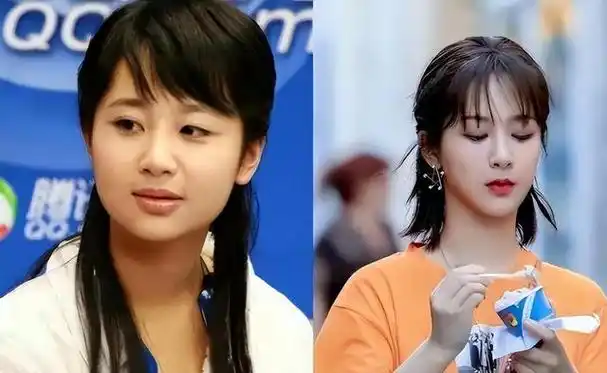 减肥拔牙长开了这6位艺人为整容而变美找的理由好离谱