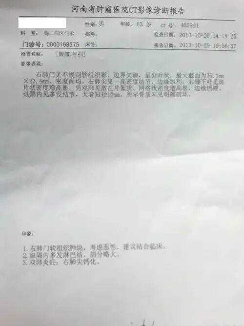 肺癌鳞癌的求助