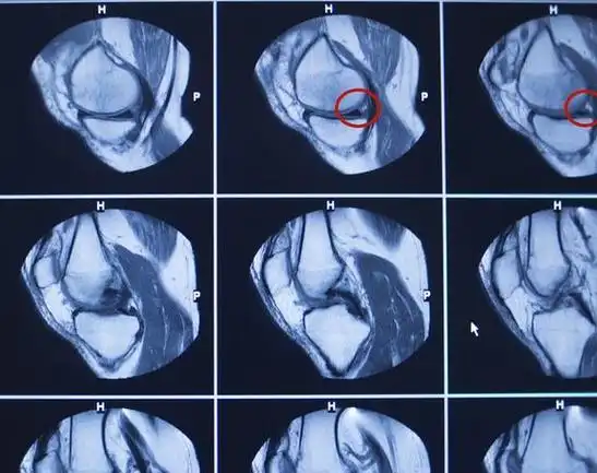 膝盖疼痛,为何不能下蹲?有啥好办法可以缓解吗?一文给