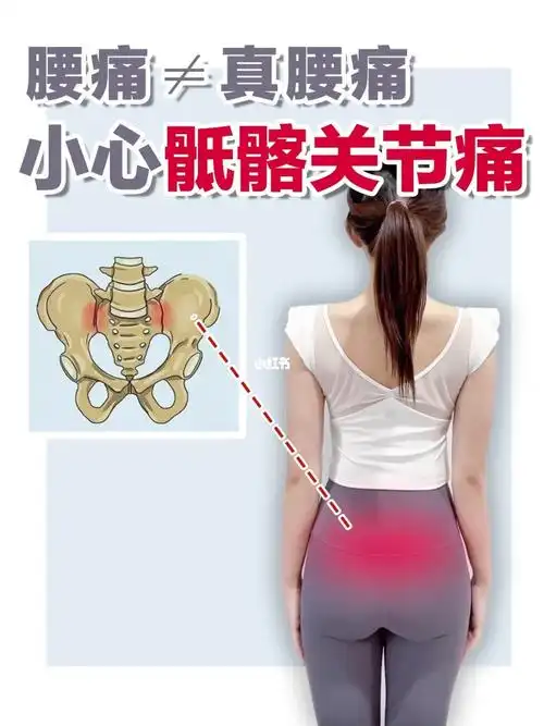 腰痛71小心不是真腰痛而是骶髂关节痛05