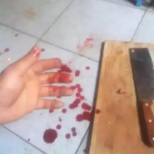 不痛苦的自残 自残社保