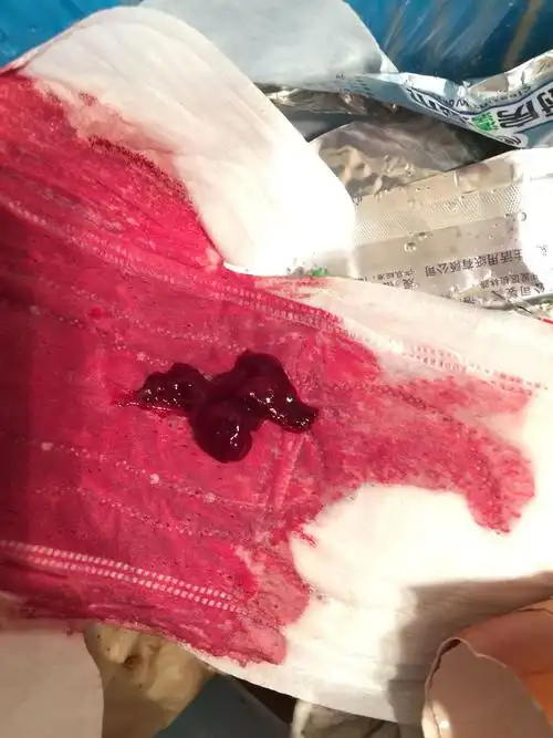 来月经有血块什么情况