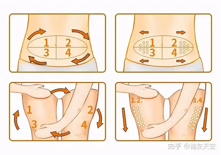 轮换胰岛素注射部位