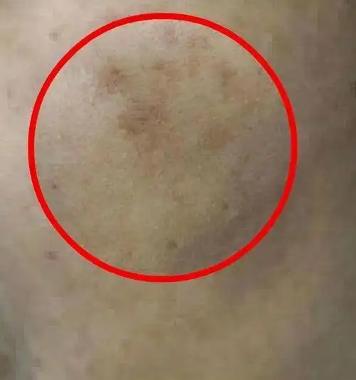 如何祛斑美白(如何祛斑美白偏方) 注册公司 第2张