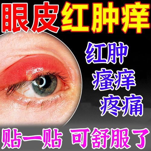 眼皮红肿痒眼睛周围过敏发痒干涩板腺疏通消除散粒肿眼膏 单盒装