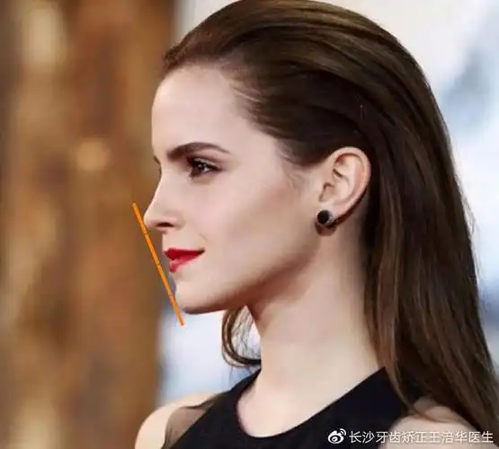 标准来看,面下部比例要占面部长度三分之一,下巴长度从下唇缘起测量