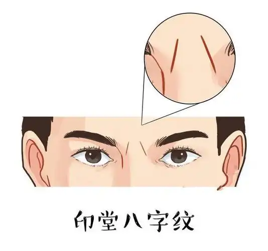 印堂八字纹图片:什么面相的男人富贵