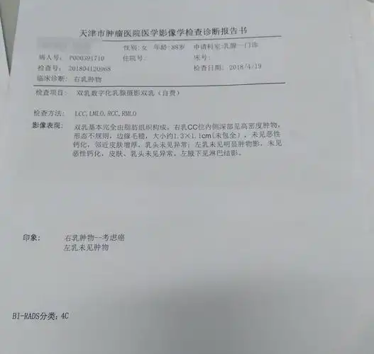 88岁老奶奶乳腺癌手术经历 - 好大夫在线