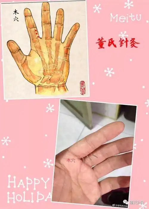 林正泰董氏针灸微课堂之木穴