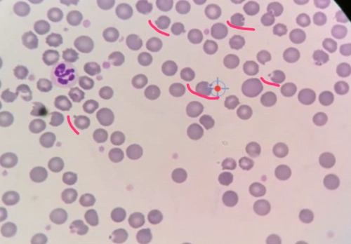 犬猫血液学检查技术与判读2认识红细胞