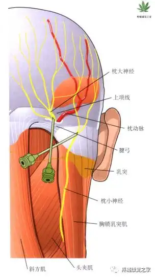 枕神经阻滞技巧