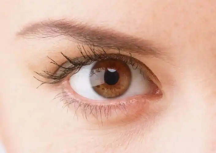 的缘故.下眼睑皮肤比较薄,最容易反映血液颜色.