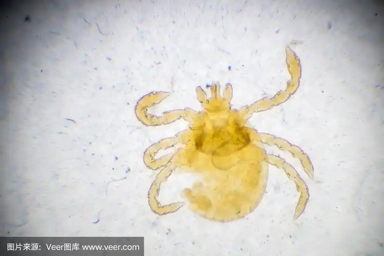 光镜下的螨类