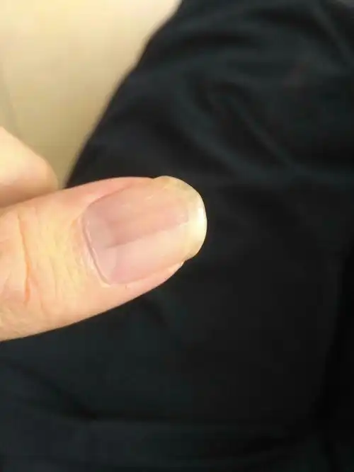 只有这只手指甲会 答题抽奖 首次认真答题后 即