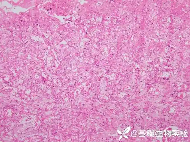 切片学习 | 常规病理组织切片及诊断要点 - 丁香园论坛