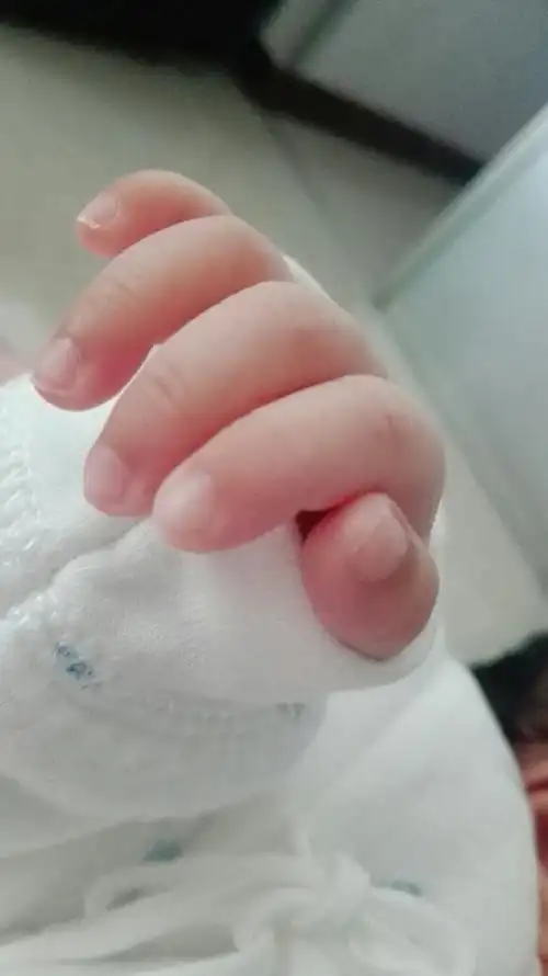 我家宝宝未满月,十根手指头的肤色,第一节都比第二三节指甲深色,这是