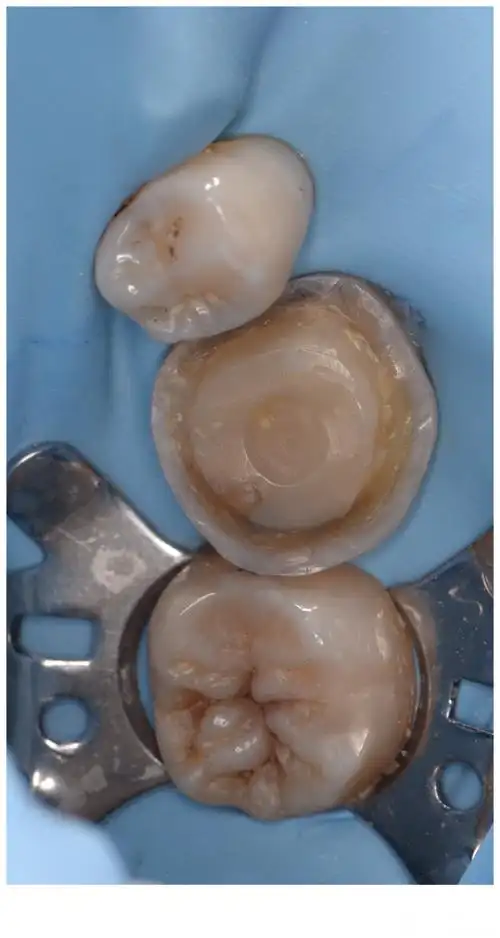 嵌体分享的同时学习blog海洋中比自己更出色的同行