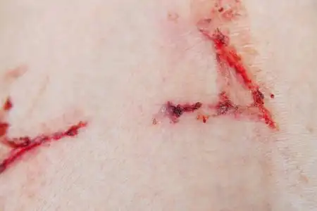 关闭在白色背景下的屁股上的流血伤口受伤的男性皮肤老年妇女的手腕