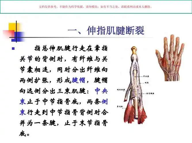 指伸屈肌腱断裂课件