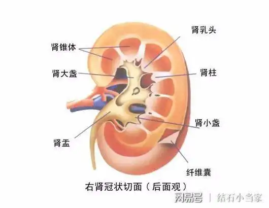 跳几下就想把结石跳出来没那么简单