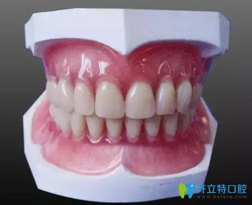 看镶全口牙价格含满口义齿和种牙价格