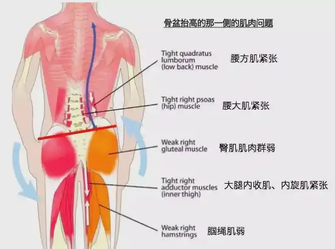 都是因为这个"舒服的姿势"|坐姿|髋关节|肌肉_网易订阅