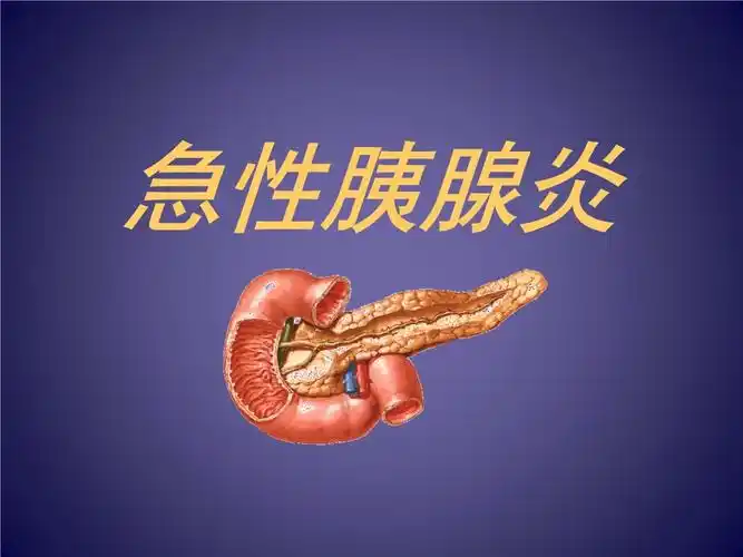内科急性胰腺炎2.ppt 60页