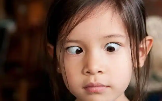 斗鸡眼图片 (30)