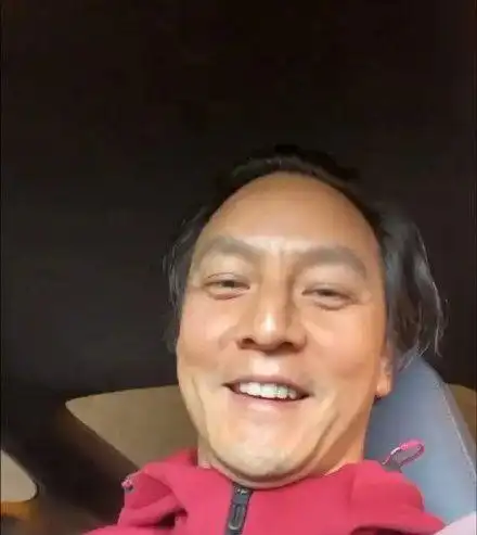 沈梦辰自曝工作焦虑致斑秃晒头顶照画面惊人